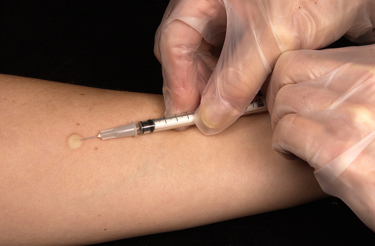 vaccination, tuberculin test, injection